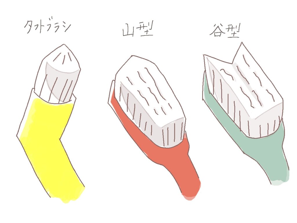 矯正中に使用する3種類の歯ブラシの説明画像